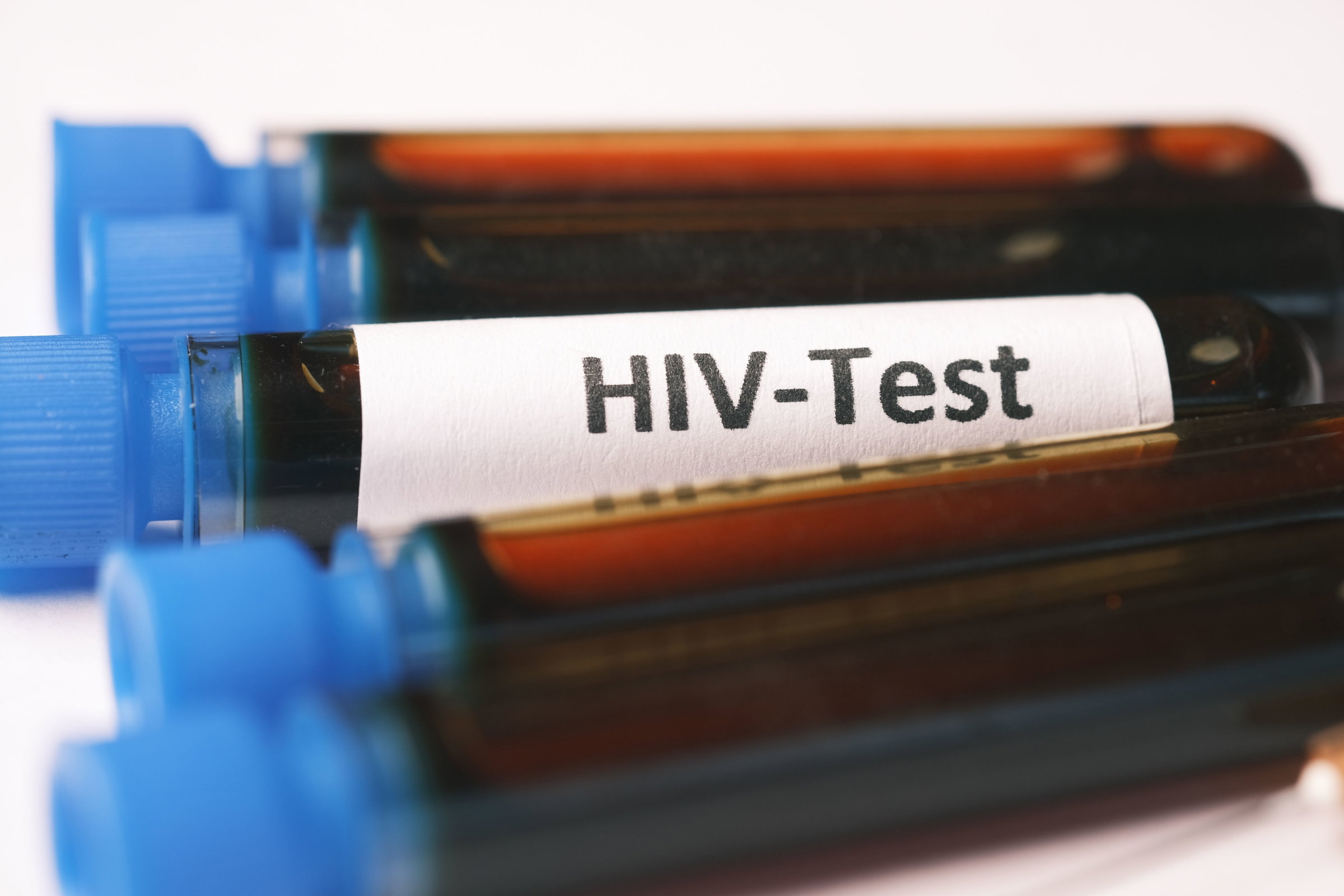 blood test