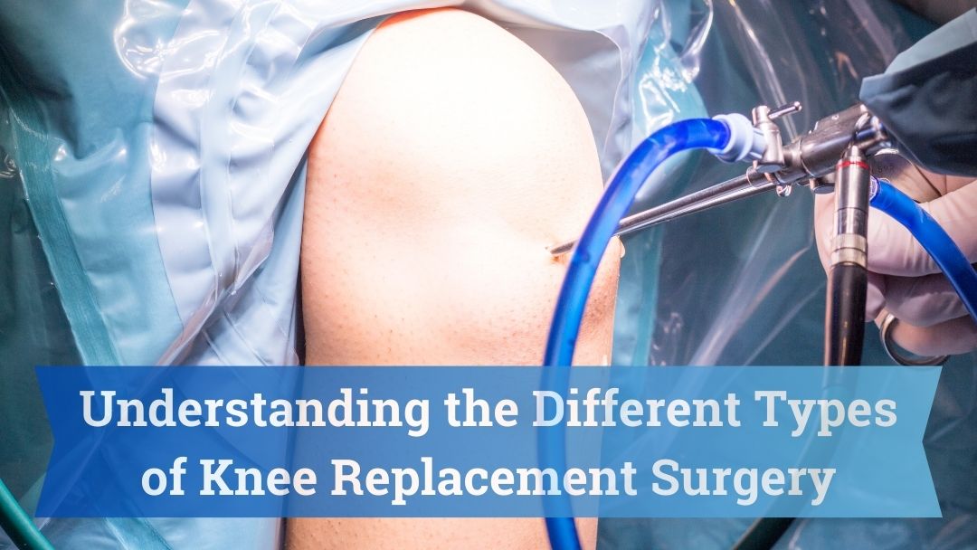 Understanding the Different Types of Knee Replacement Surgery