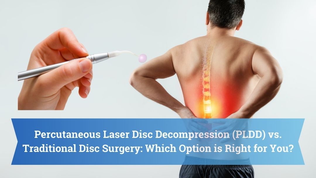 Percutaneous Laser Disc (PLDD) vs. Traditional Disc