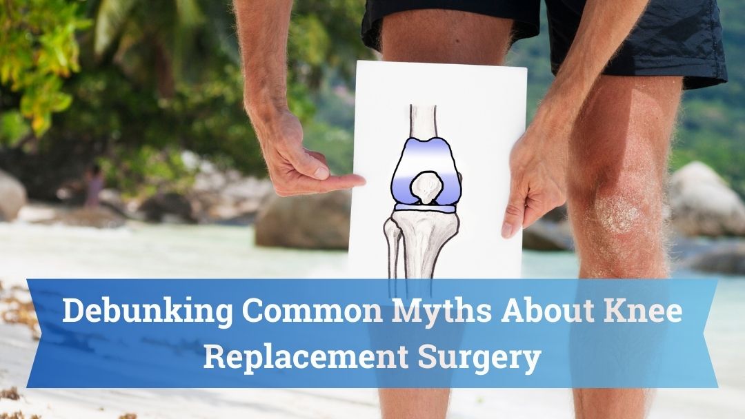 Debunking Common Myths About Knee Replacement Surgery