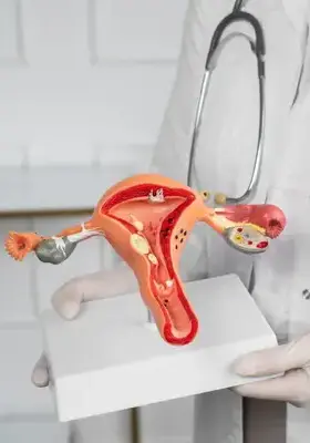 Model anatomic al uterului – explicație vizuală a cancerului endometrial