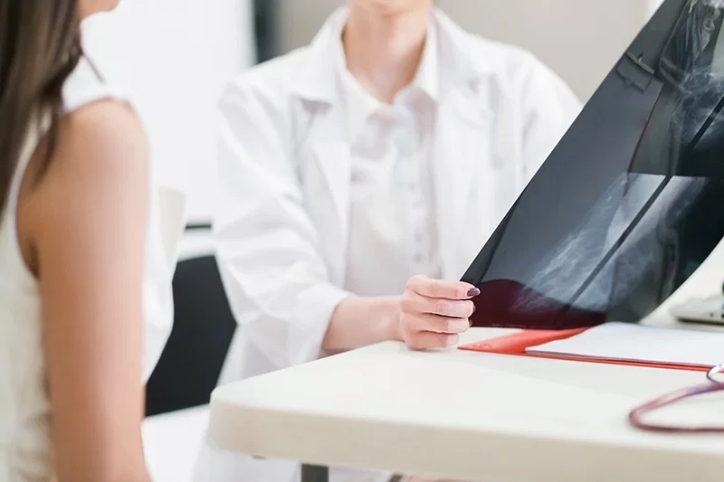 Consult medical pentru evaluarea unui nodul mamar