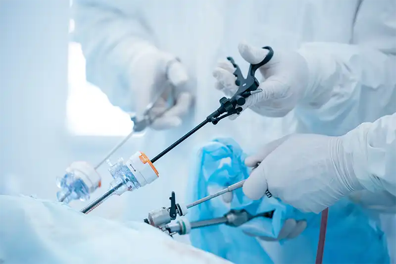 Histerectomie laparoscopica vs abdominala tehnici chirurgicale
