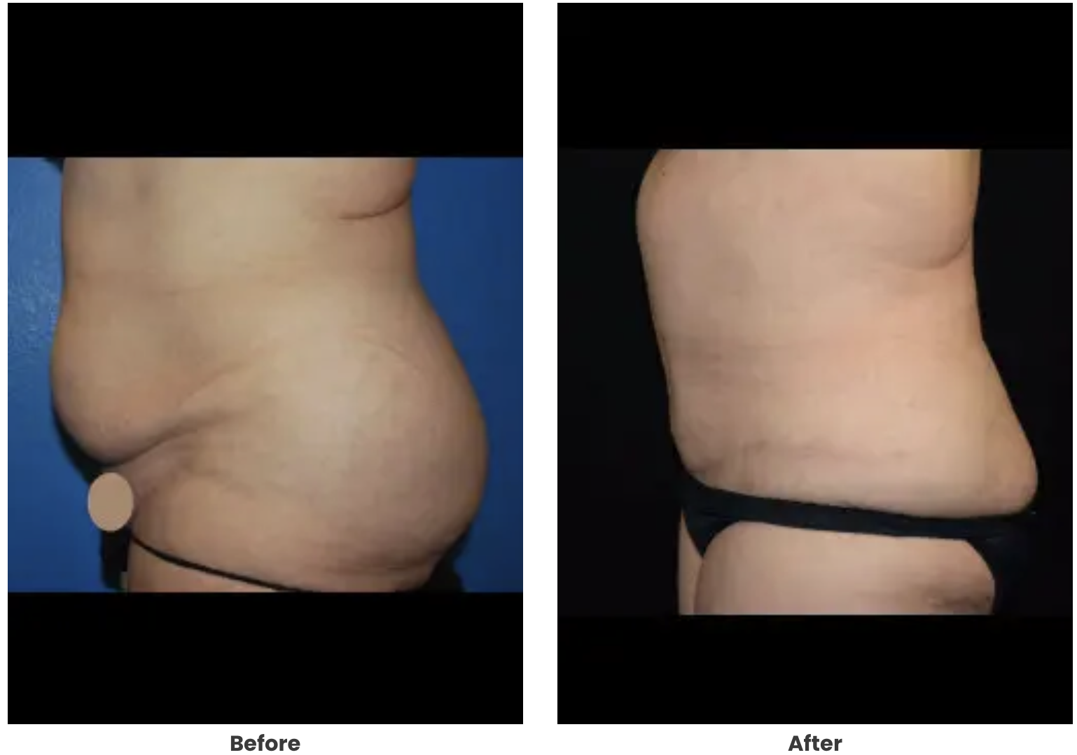 undefined